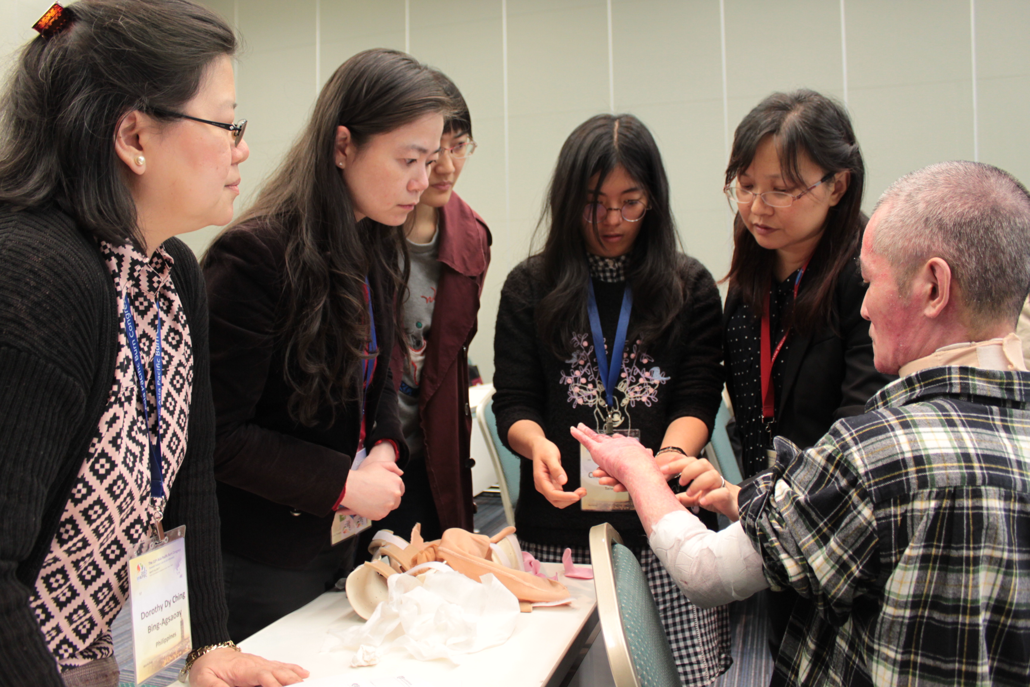 Burn rehabilitation workshop during APBC 2017