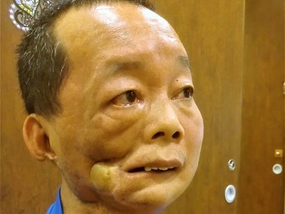 活下來，只為陪伴孩子長大 -口友 張慶彬