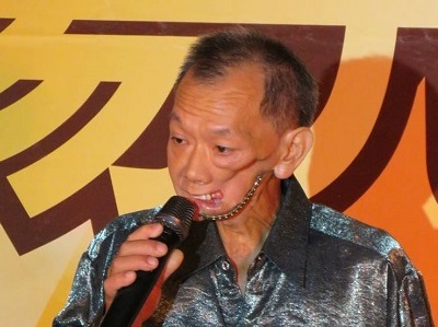 癌末下的缺角人生 用痛口唱出生命樂章 -口友 阿德大哥