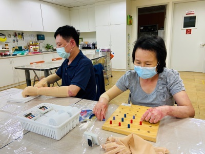 燒傷朋友的平凡「日常」