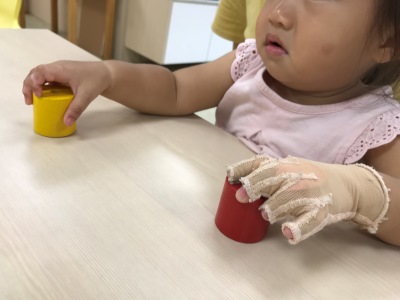 與陽光壓力治療的偶然相逢