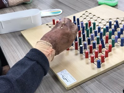 陽光人看見的陽光心情：傷疤，是他們的故事