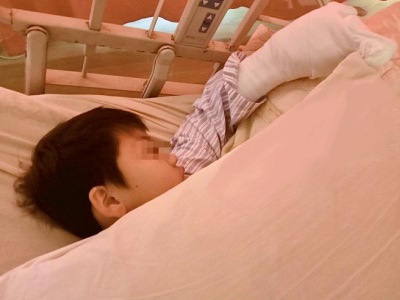 重視幼兒活動安全，摩擦性灼傷勿輕忽
