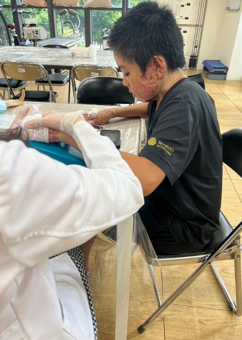 小宥忍痛進行手部復健。